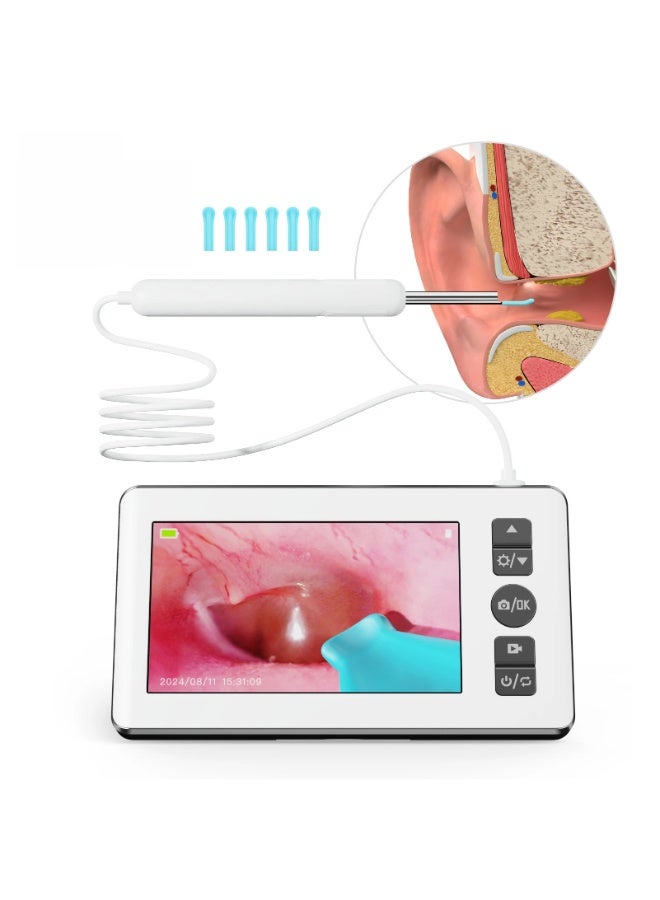 general Visual Ear Cleaning Kit with Screen HD Digital Ear Pick Memory Card Supported Type-C Rechargeable - Image 1